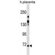 Zinc Finger Protein 251 (ZNF251) Antibody