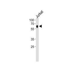 Nuclear Receptor Subfamily 2 Group C Member 2 (NR2C2) Antibody