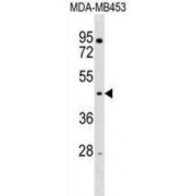 E3 Ubiquitin-Protein Ligase RNF128 (RNF128) Antibody