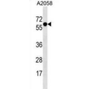 Synaptotagmin 4 (SYT4) Antibody
