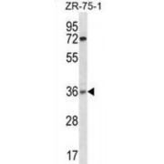 X-Ray Repair Cross-Complementing Protein 2 (XRCC2) Antibody
