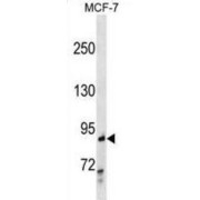 RalA-Binding Protein 1 (RALBP1) Antibody