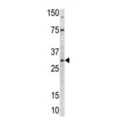 Mitochondrial Ribosomal Protein L24 (MRPL24) Antibody