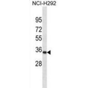 Paired Mesoderm Homeobox Protein 1 (PRRX1) Antibody