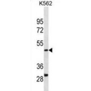Dihydroorotate Dehydrogenase (DHODH) Antibody
