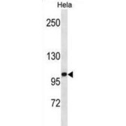 Zinc Fingers and Homeoboxes Protein 1 (ZHX1) Antibody