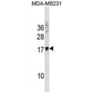 abx031016