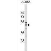 Ring Finger And FYVE Like Domain Containing E3 Ubiquitin Protein Ligase (RFFL) Antibody