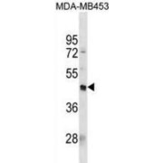 Programmed Cell Death Protein 2-Like (PDCD2L) Antibody