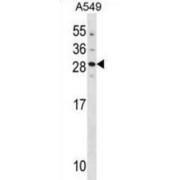 Guanylyl Cyclase-Activating Protein 2 (GUCA1B) Antibody