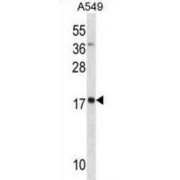 Myosin Light Chain 4 (MYL4) Antibody