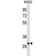 Vesicle-Associated Membrane Protein-Associated Protein A (VAPA) Antibody