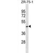 Alpha-N-Acetylgalactosaminide Alpha-2,6-Sialyltransferase 5 (ST6GALNAC5) Antibody