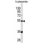 Tektin 3 (TEKT3) Antibody