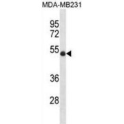 Putative E3 Ubiquitin-Protein Ligase UBR7 (UBR7) Antibody