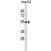 Zinc Finger Protein 101 (ZNF101) Antibody