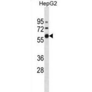 Zinc Finger Protein 205 (ZNF205) Antibody