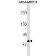 Metal Transporter CNNM3 (CNNM3) Antibody