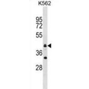 RING Finger Protein 175 (RNF175) Antibody