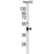 LIM/Homeobox Protein Lhx4 (LHX4) Antibody
