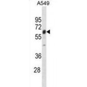 Tripartite Motif Containing 22 (TRIM22) Antibody