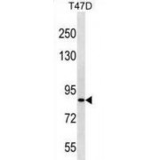 Zinc Finger Protein 43 (ZNF43) Antibody