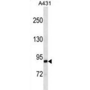 EPS8 Like 2 (EPS8L2) Antibody