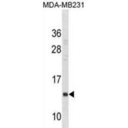 Interferon Induced Transmembrane Protein 1 (IFITM1) Antibody