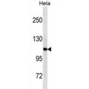 Lon Protease Homolog, Mitochondrial (LONP1) Antibody