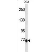 Chloride Intracellular Channel 6 (CLIC6) Antibody