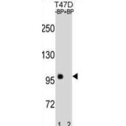 Catenin Beta 1 (CTNNB1) Antibody