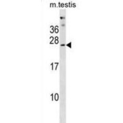 Pyridoxal Phosphate Phosphatase PHOSPHO2 (PHOSPHO2) Antibody