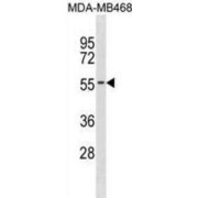 Potassium Two Pore Domain Channel Subfamily K Member 6 (KCNK6) Antibody