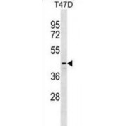 DnaJ (Hsp40) Homolog, Subfamily B, Member 12 (DNAJB12) Antibody