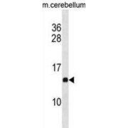 Prefoldin Subunit 2 (PFDN2) Antibody