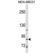 Trophinin Associated Protein (TROAP) Antibody