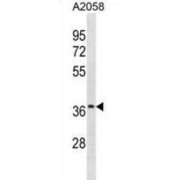 Olfactory Receptor 52J3 (OR52J3) Antibody