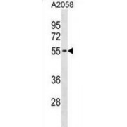 Thioredoxin Related Transmembrane Protein 3 (TMX3) Antibody