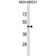 C-C Chemokine Receptor Type 5 (CCR5) Antibody