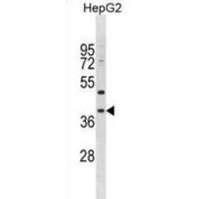 Metallophosphoesterase Domain-Containing Protein 1 (MPPED1) Antibody