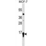 Histone Cluster 2, H3a (HIST2H3A) Antibody