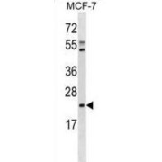 3-Beta Hydroxysteroid-Delta-8, Delta-7 Isomerase (EBP) Antibody