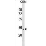 Phosphoribosyl Pyrophosphate Synthetase 1-Like 1 (PRPS1L1) Antibody