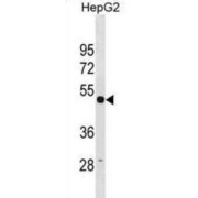 Tubulin Gamma 1 (TUBG1) Antibody
