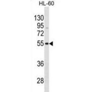 Vasoactive Intestinal Peptide Receptor (VIPR1) Antibody