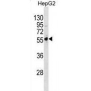 26S Proteasome Non-ATPase Regulatory Subunit 5 (PSMD5) Antibody