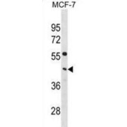 Choline-Phosphate Cytidylyltransferase A (PCYT1A) Antibody