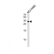 Achaete-Scute Homolog 1 (ASCL1) Antibody