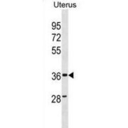 Zinc Finger CCCH-Type Antiviral Protein 1-Like (ZC3HAV1L) Antibody