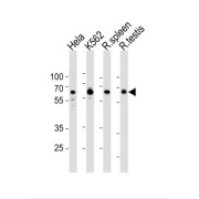 Histone Deacetylase 1 (HDAC1) Antibody